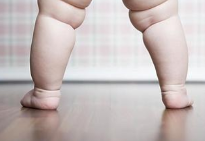孩子体重超标易引起性早熟
